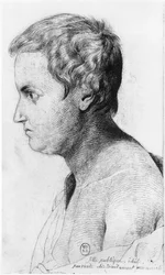 Prostituta idiota affetta da sifilide, illustrazione da un trattato inedito di Jean Etienne Dominique Esquirol (1772-1840) sui pazzi dell